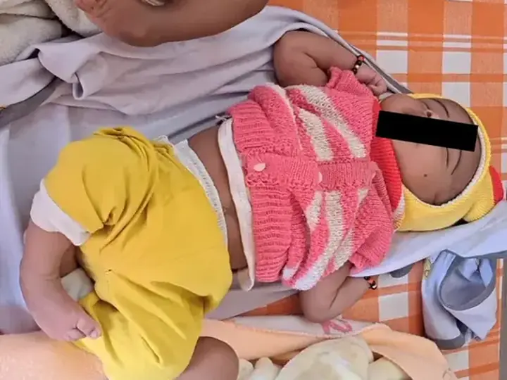 Clubfoot correction