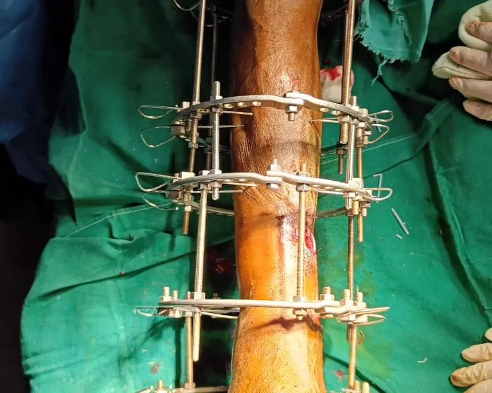 Ilizarov external fixator