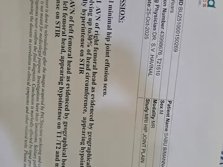 Ozone therapy for AVN