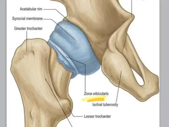 Hip ozone therapy procedure