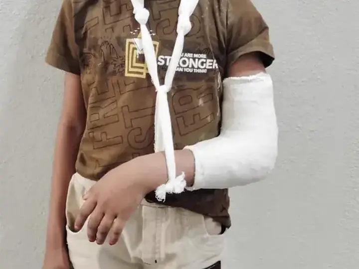 Paediatric elbow fracture