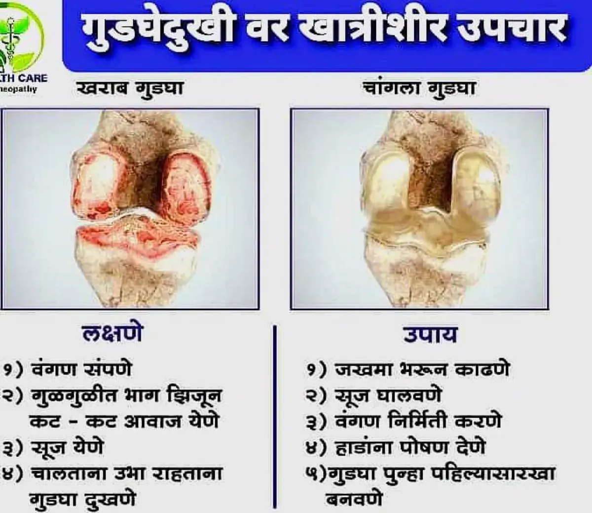 गुडघेदुखीवरील उपचार