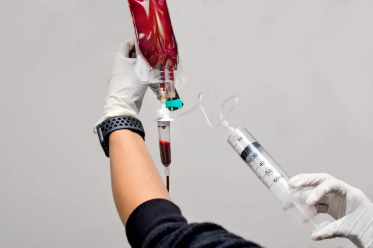 Ozonated blood — major autohemotherapy